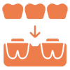 Implantatgetragene Br&uuml;cke